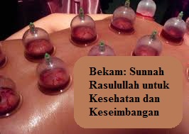 Bekam: Sunnah Rasulullah untuk Kesehatan dan Keseimbangan